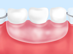 入れ歯・義歯