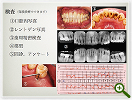 六本木駅前歯科での歯周病治療検査